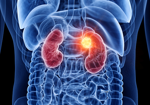 xray of kidney