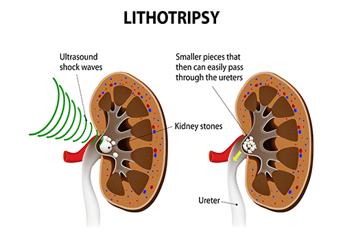 kidney