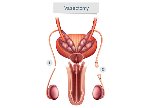 drawing of penis